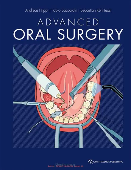 کاور جراحی دهان پیشرفته — فیلیپی، ساکاردین، کوله